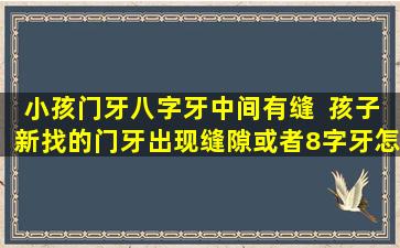 小孩门牙八字牙中间有缝  孩子新找的门牙出现缝隙或者8字牙怎么办